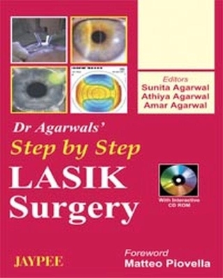 Step by Step Lasik Surgery -  Sharma Namrata