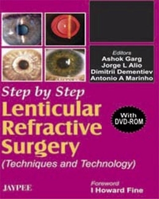 Step by Step Lenticular Refractive Surgery - Lin Garg