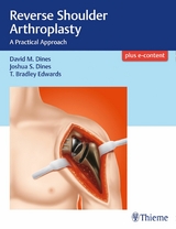 Reverse Shoulder Arthroplasty -  David M. Dines,  Joshua Dines,  T Bradley Edwards