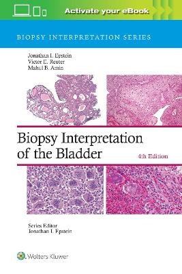 Biopsy Interpretation of the Bladder: Print + eBook with Multimedia - Jonathan I. Epstein, Victor E. Reuter, Mahul B. Amin