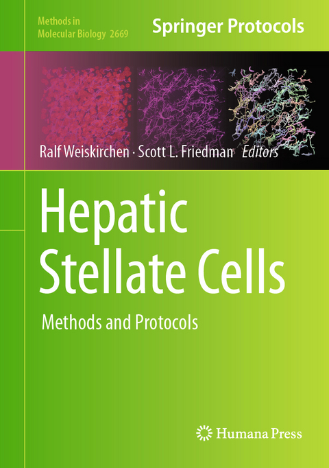 Hepatic Stellate Cells - 