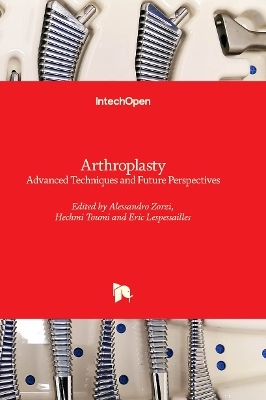 Arthroplasty - 