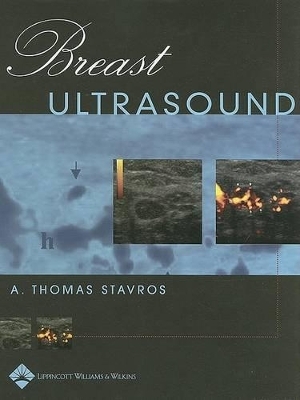 Breast Ultrasound - A. Thomas Stavros