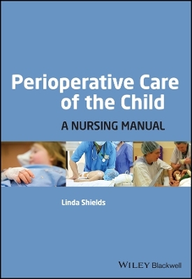 Perioperative Care of the Child - 