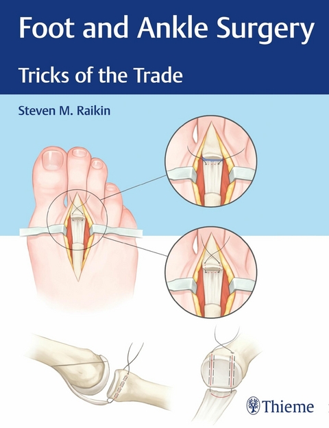 Foot and Ankle Surgery -  Steven M. Raikin