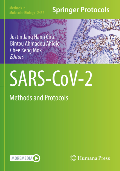 SARS-CoV-2 - 