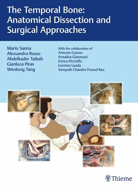 The Temporal Bone -  Mario Sanna,  Alessandra Russo,  Abdelkader Taibah,  Gianluca Piras,  Wenlong Tang