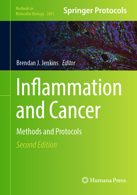 Inflammation and Cancer - 