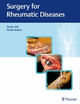 Surgery for Rheumatic Diseases -  Stefan Sell,  Stefan Rehart