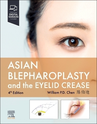 Asian Blepharoplasty and the Eyelid Crease - William P. Chen