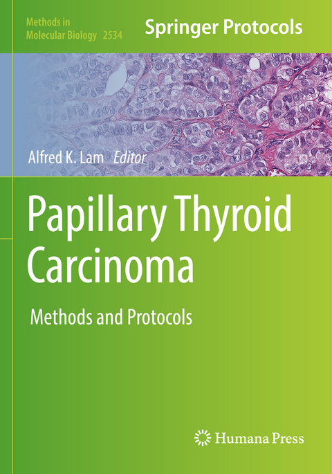 Papillary Thyroid Carcinoma - 