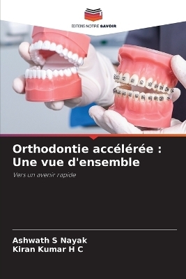 Orthodontie accélérée - Ashwath S Nayak, Kiran Kumar H C