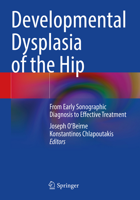 Developmental Dysplasia of the Hip - 