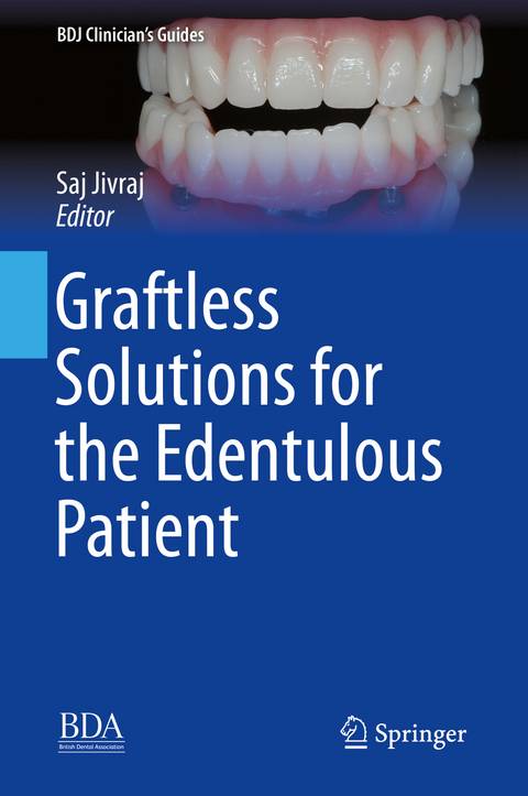 Graftless Solutions for the Edentulous Patient - 