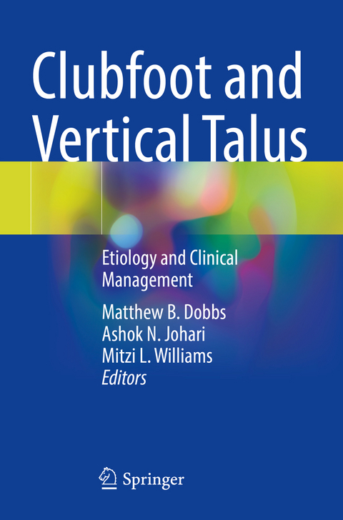 Clubfoot and Vertical Talus - 