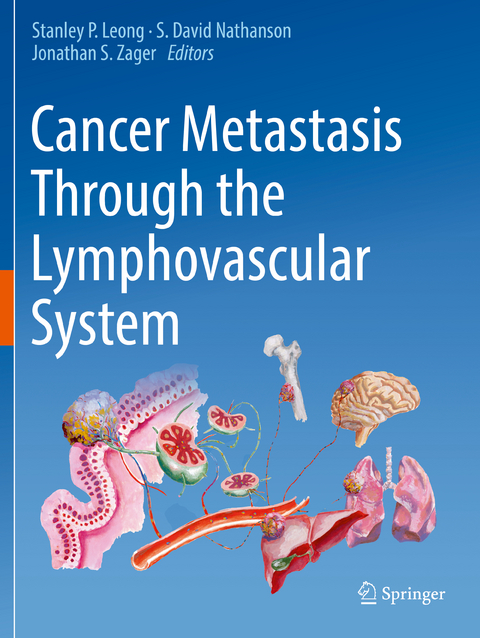 Cancer Metastasis Through the Lymphovascular System - 