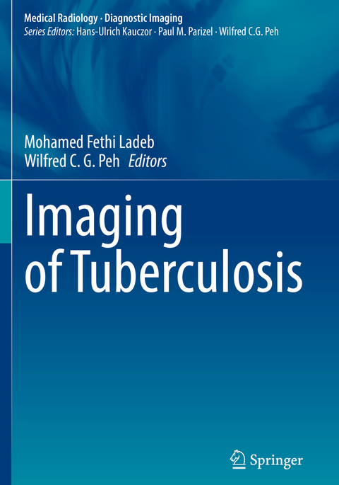 Imaging of Tuberculosis - 