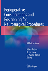 Perioperative Considerations and Positioning for Neurosurgical Procedures - 