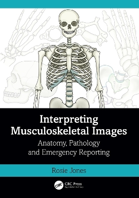 Interpreting Musculoskeletal Images - Rosie Jones