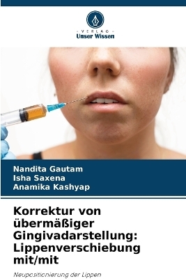 Korrektur von übermäßiger Gingivadarstellung - Nandita Gautam, Isha Saxena, Anamika Kashyap