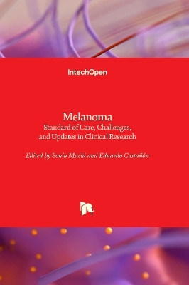 Melanoma - 