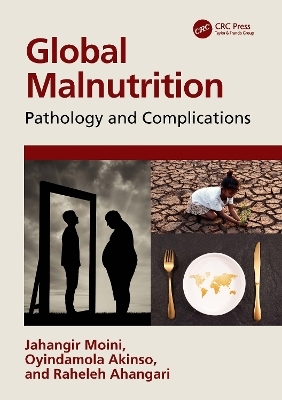 Global Malnutrition - Jahangir Moini, Oyindamola Akinso, Raheleh Ahangari