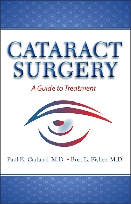 Cataract Surgery - Bret L Fisher, Paul E Garland