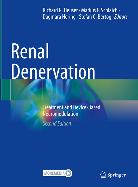 Renal Denervation - 