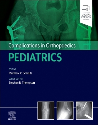 Complications in Orthopaedics: Pediatrics - 