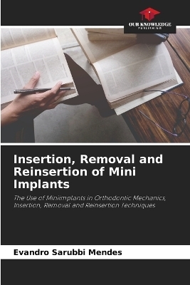 Insertion, Removal and Reinsertion of Mini Implants - Evandro Sarubbi Mendes