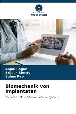 Biomechanik von Implantaten - Anjali Sajjan, Brijesh Shetty, Suhas Rao