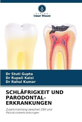 Schläfrigkeit Und Parodontal- Erkrankungen - Dr Stuti Gupta, Dr Rupali Kalsi, Dr Rahul Kumar