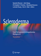 Scleroderma - Allanore, Yannick; Varga, John; Denton, Christopher P.; Kuwana, Masataka; Chung, Lorinda; Shah, Ami A.