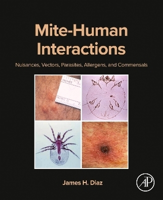 Mite-Human Interactions - James H. Diaz