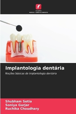 Implantologia dentária - Shubham Setia, Soniya Gurjar, Ruchika Choudhary