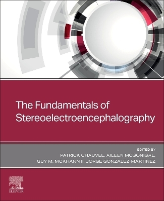 The Fundamentals of Stereoelectroencephalography - 