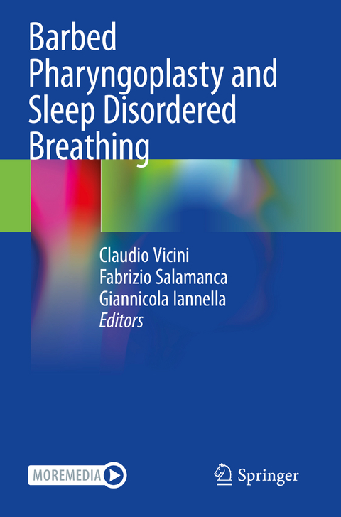 Barbed Pharyngoplasty and Sleep Disordered Breathing - 