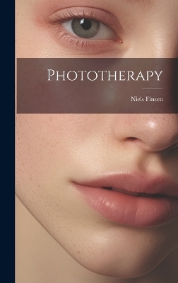 Phototherapy - Niels Finsen