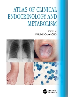 Atlas of Clinical Endocrinology and Metabolism - 