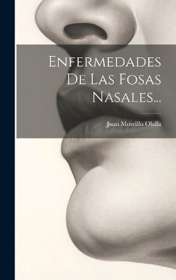 Enfermedades De Las Fosas Nasales... - Juan Morcillo Olalla