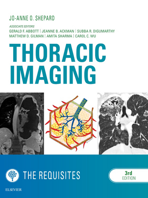 Thoracic Imaging The Requisites E-Book -  Jo-Anne O Shepard