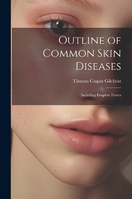 Outline of Common Skin Diseases - Thomas Caspar Gilchrist