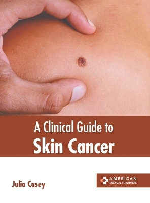 A Clinical Guide to Skin Cancer - 