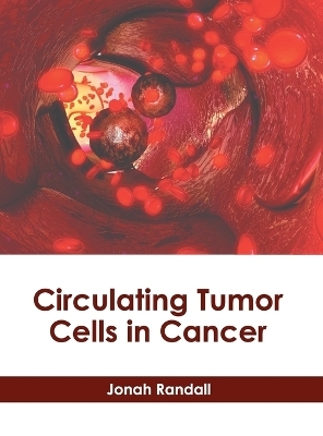 Circulating Tumor Cells in Cancer - 