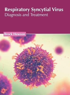 Respiratory Syncytial Virus: Diagnosis and Treatment - 