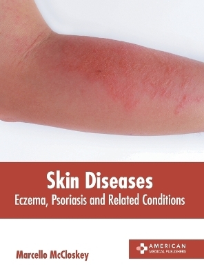 Skin Diseases: Eczema, Psoriasis and Related Conditions - 