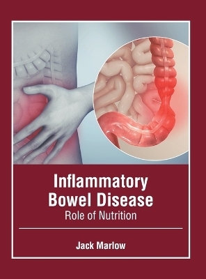 Inflammatory Bowel Disease: Role of Nutrition - 