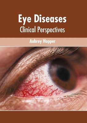 Eye Diseases: Clinical Perspectives - 