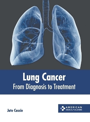 Lung Cancer: From Diagnosis to Treatment - 