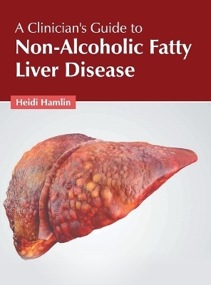 A Clinician's Guide to Non-Alcoholic Fatty Liver Disease - 